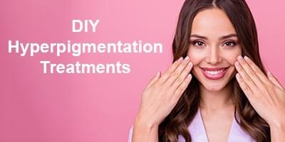 Woman showing off her face with text that reads "DIY Hyperpigmentation Treatments"